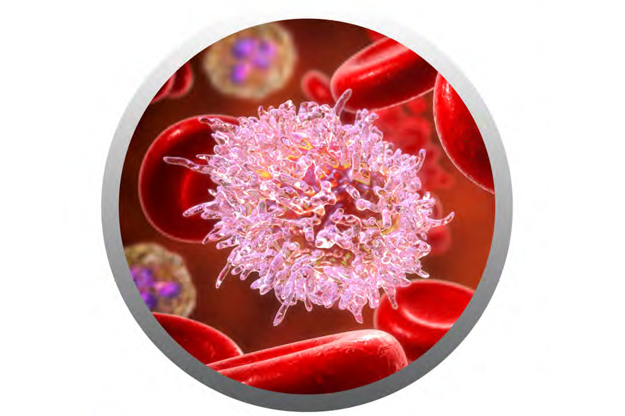 ตัวรับแอนติเจนทีเซลล์รักษาผู้ป่วยโรคมะเร็งเม็ดเลือดขาวด้วยเซลล์บำบัด (CAR-CD19 Therapy)