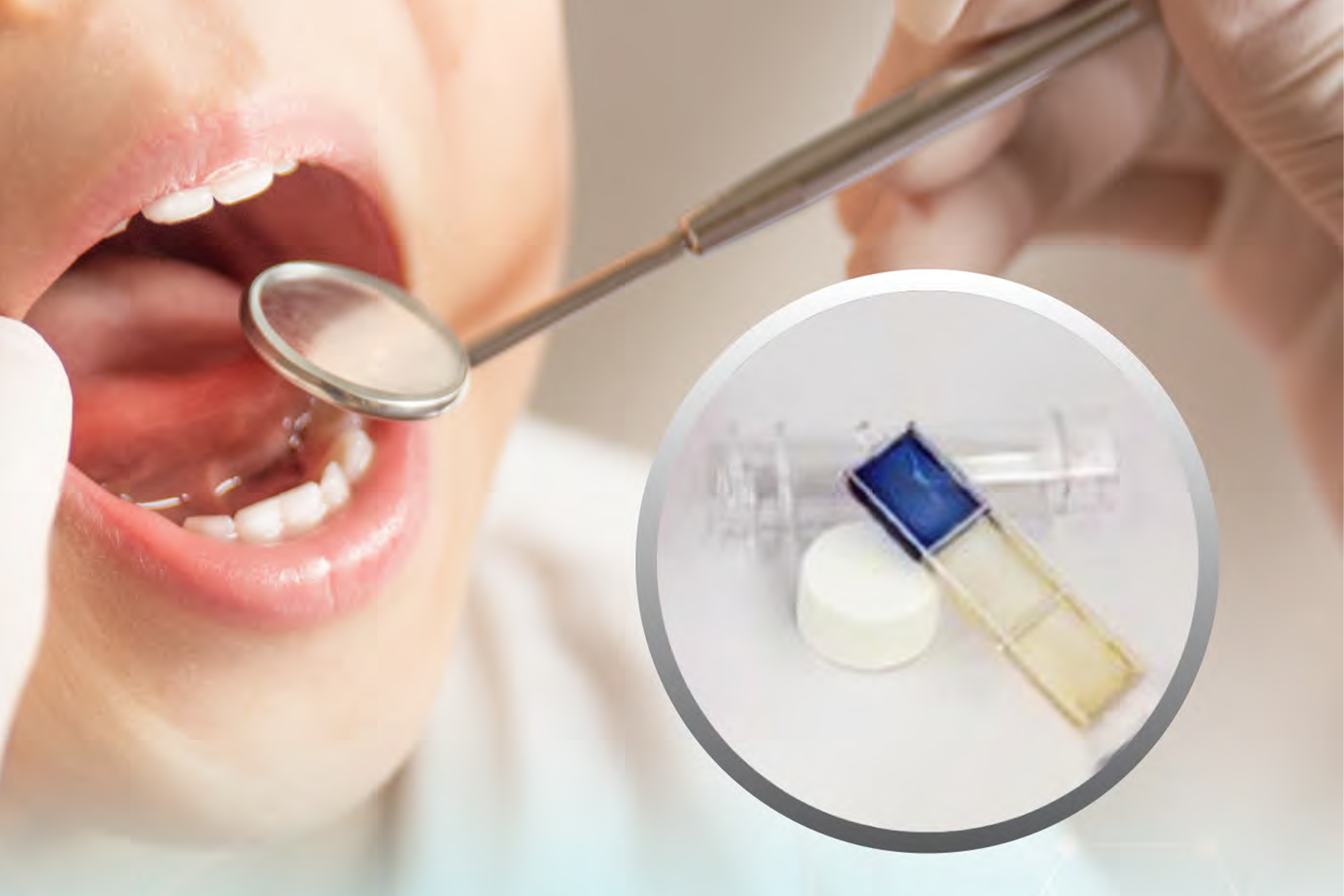 ชุดตรวจประเมินความเสี่ยงต่อโรคฟันผุ